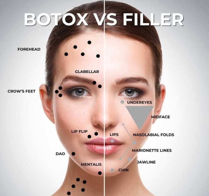 Botox vs acid hialuronic — diferențe și indicații