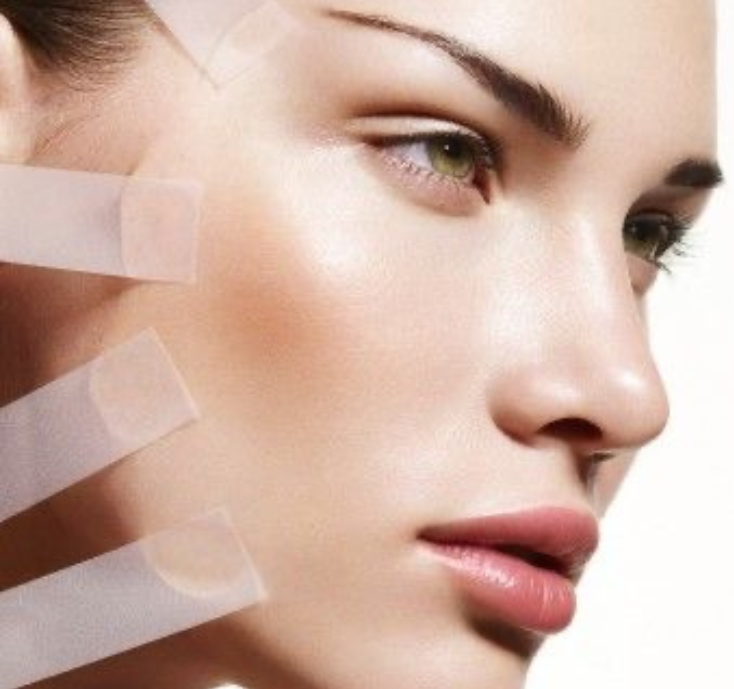 Lifting facial non-chirurgical cu fire PDO